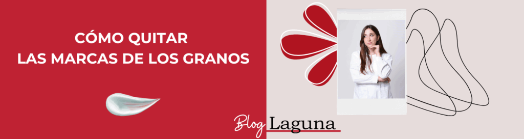 cómo quitar las marcas de los granos