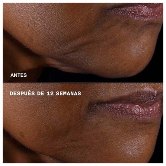 Clinique Smart Clinical Repair Lifting Face + Neck Cream 75Ml 2