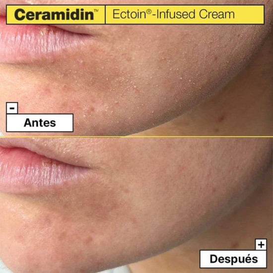 Dr.Jart+ Ceramidin crema con ectoína 50ml 2