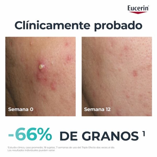 Eucerin DermoPure Oil Control Sérum 40ml 2