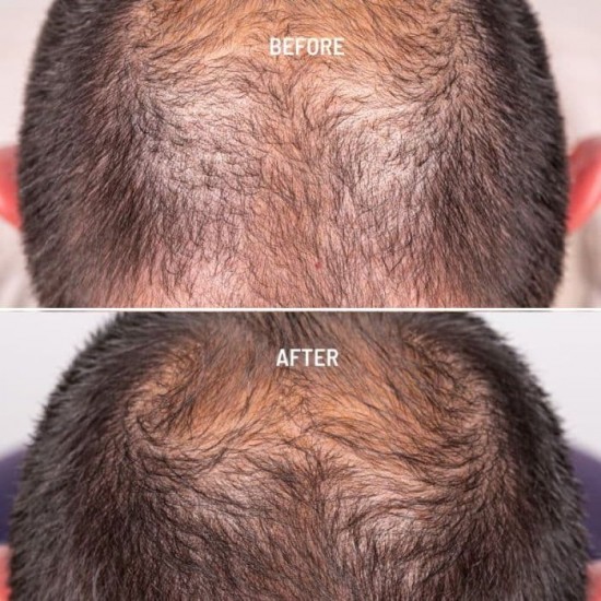 FRESHLY COSMETICS Hair Growth & Density Treatment 50ml 4