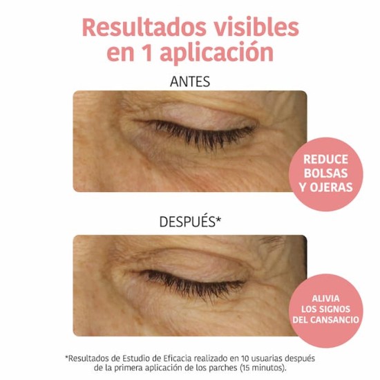 Iroha Mascarilla Contorno De Ojos Vitamina C 2UD 2