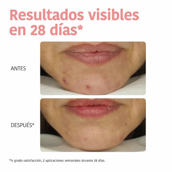 Iroha Mascarilla Peeling Glycolic Acid 1UD 3