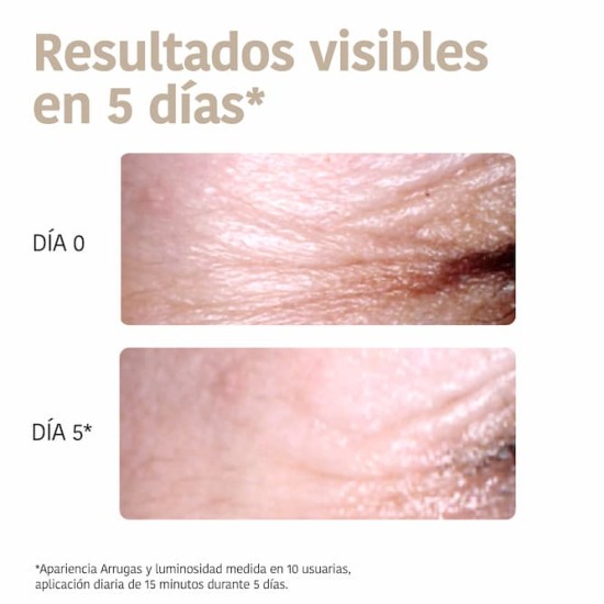 Iroha Parches Ojos 2UD 3