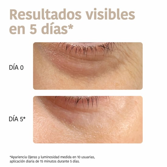 Iroha Parches Ojos 2UD 5