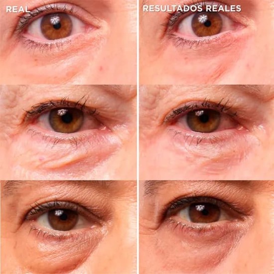 It Cosmetics Bye Bye Under Eye Bags 15ml 1