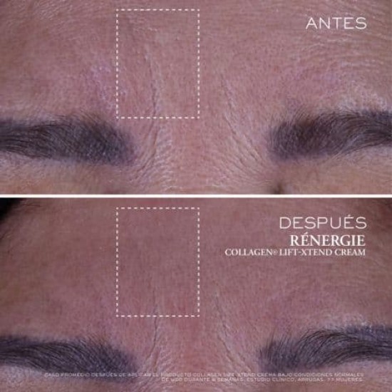 Lancôme Rénergie Collagen Lift-Xtend Cream 50ml 3