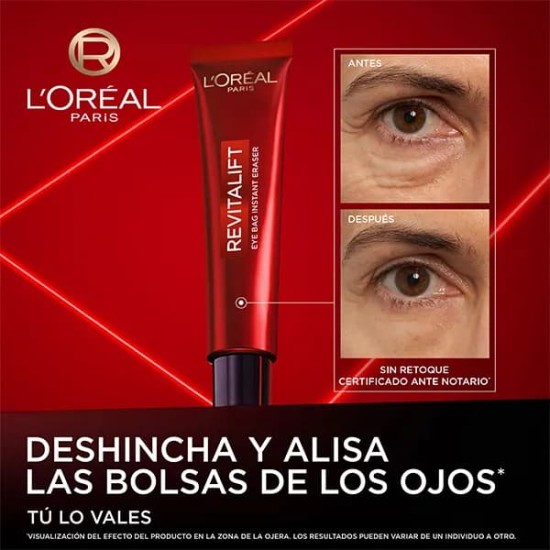 L\'Oreal Revitalift Laser Eye Bag Eraser 15Ml 2