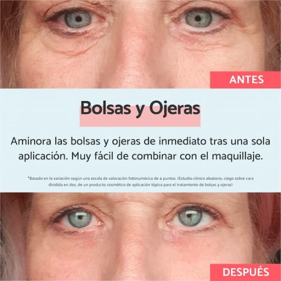 Remescar Bolsas Y Ojeras 8ml 1