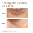 Iroha Parches Ojos 2UD 5