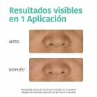 Iroha Tiras Detox 5UD 3