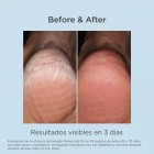 Isdin Ureadin Podos 75Ml 3