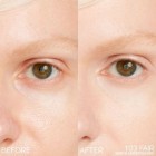 Shiseido Synchro Skin Radiant Lifting Concealer 103 1