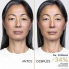 Shiseido Vital Perfection Liftdefine Radiance Sérum Night 40Ml 2